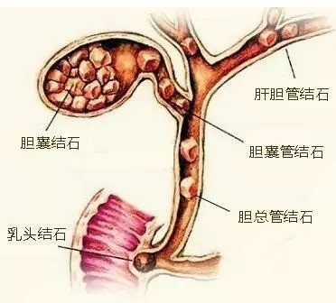 22.jpg 22.jpg