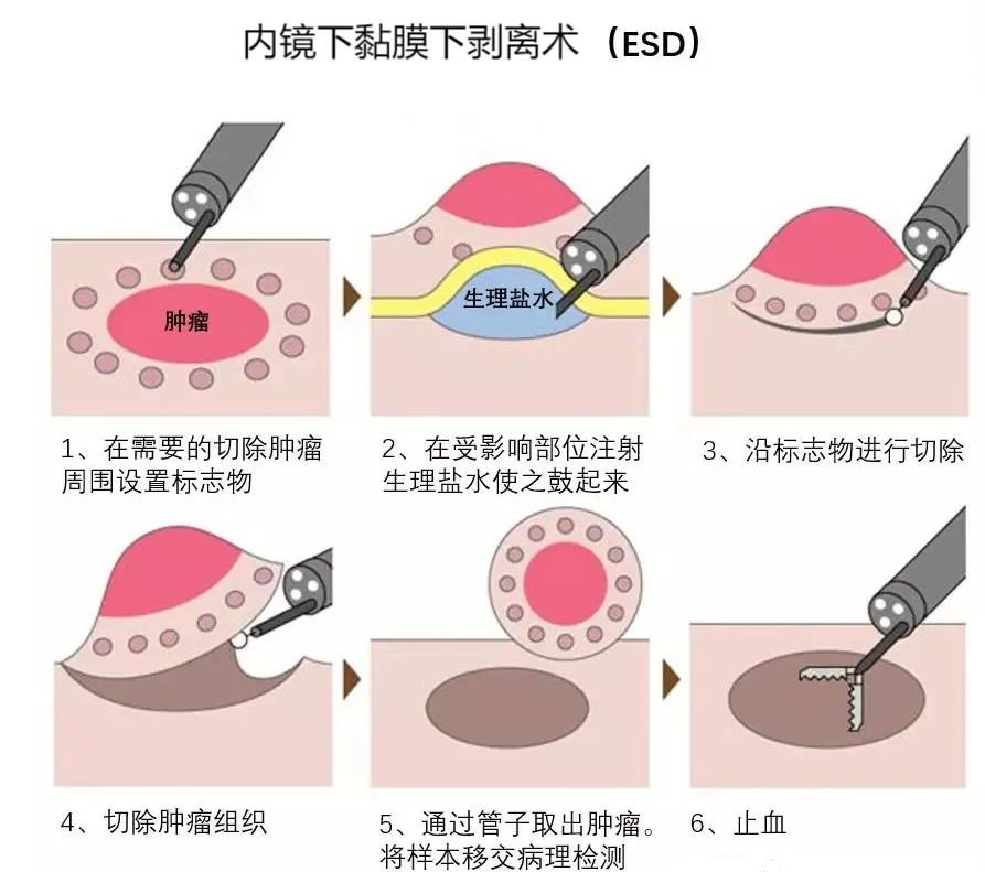 图片5.png 图片5.png